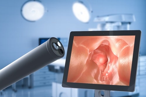 Colonoscopy Department