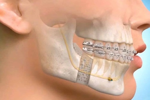 Maxillofacial Department